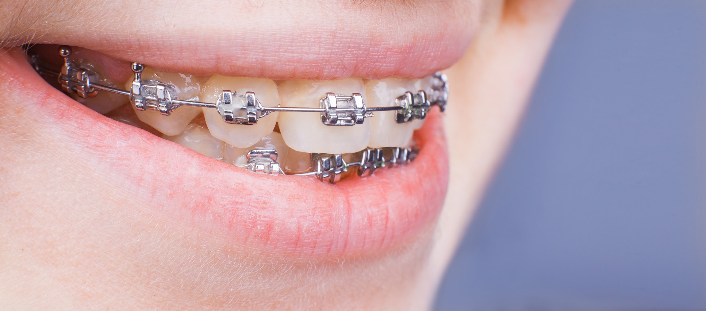 Dr. Bill Willard Zurcher Orthodontist in Draper, UT 84020 West Jordan, UT 84084